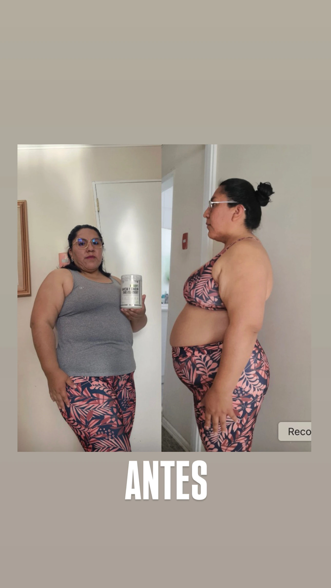 Antes: mujer con polera gris y calzas rosadas estampadas, en fotografías de frente y de perfil