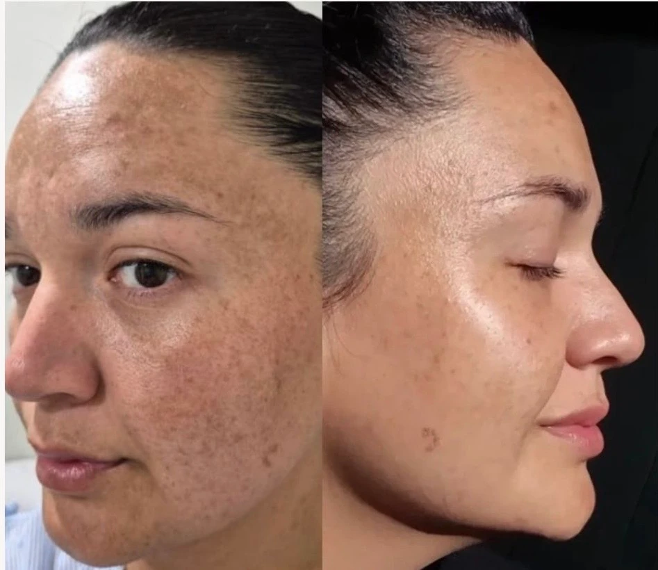 Registro fotográfico del rostro compartido para la sección de experiencias de RENÖVA+